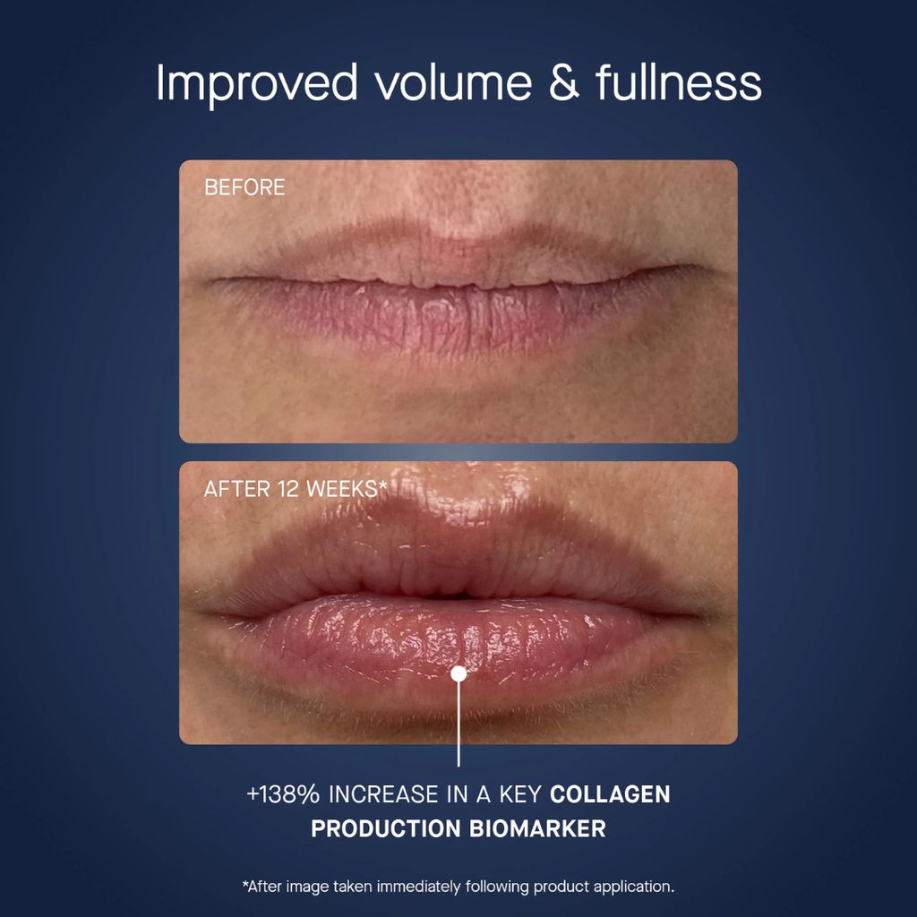 OS-01 Lip Mask - Image 6